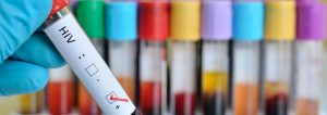 HIV lab tests