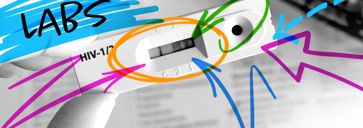 Hiv Lab Tests Understanding Your Cd4 And Viral Load Results 7586